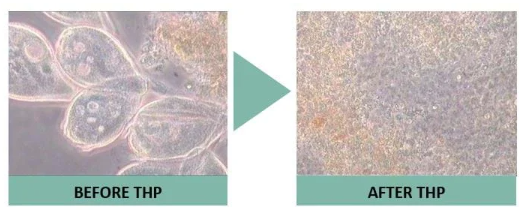 Sludge before and after thermal hydrolysis. Waste activated sludge floccs
